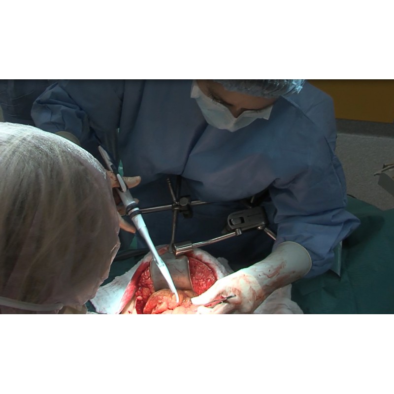 CR - Health care - operating room - doctors - operation - intestine