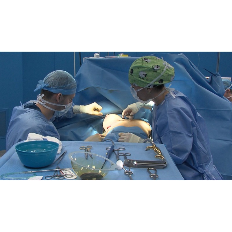 CR - health - people - woman - breast - operation - plastic surgeryČR - zdraví - lidé - žena - prsa - operace - plastika