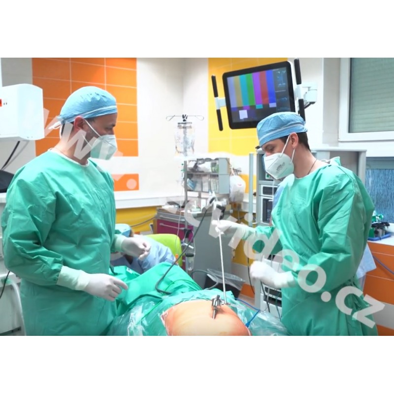 CZ - Pilsner - health care - hospital - gynecology - oncology - operation - robot - cancer - 4K