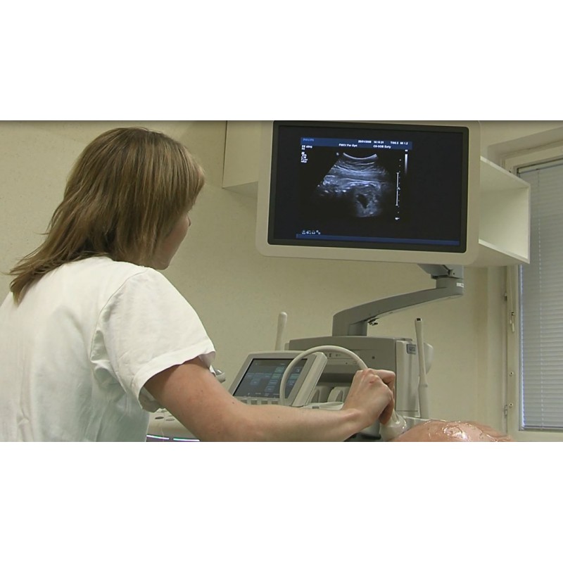 ČR - porodnice - ultrazvuk - těhotná žena - vyšetření