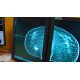 ČR - zdravotnictví - mamografie - vyšetření