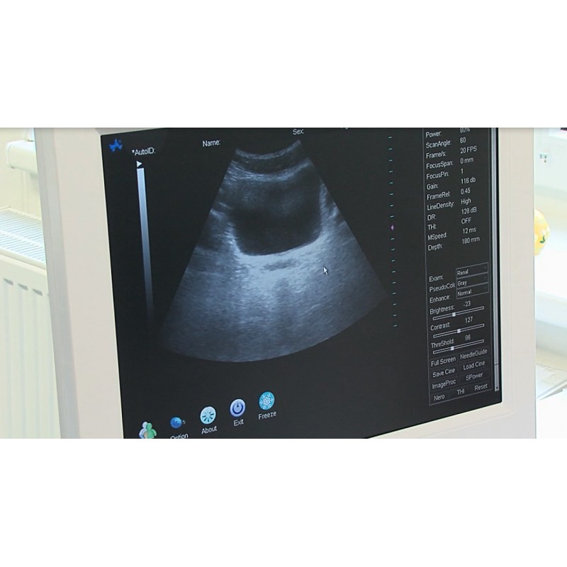CR - healthcare - urology - urinary bladder examination - probe