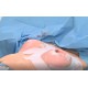 CR - health - people - woman - breast - operation - plastic surgery 2